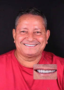 antes-depois-04