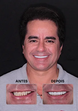 antes-depois-07