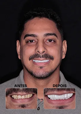 antes-depois-08