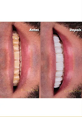 antes-depois-16
