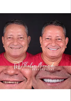 antes-depois-18